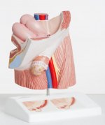 inguinal hernia.jpg