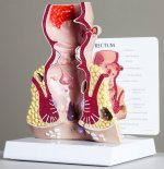Rectum small.jpg
